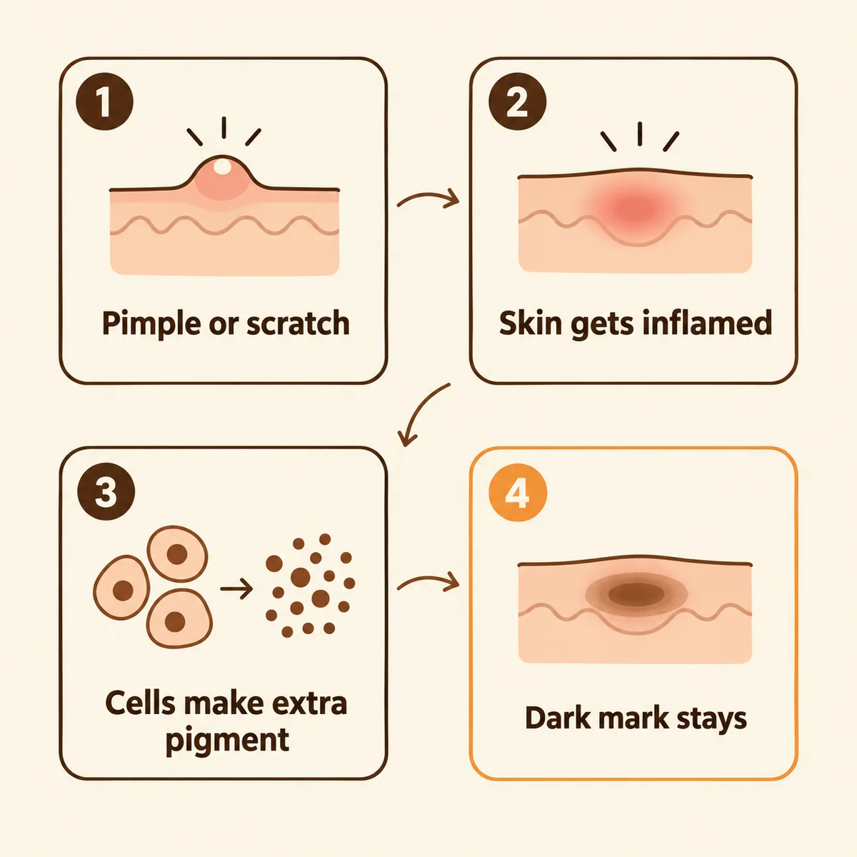 Four-step flow showing how skin irritation leads to a lasting dark mark